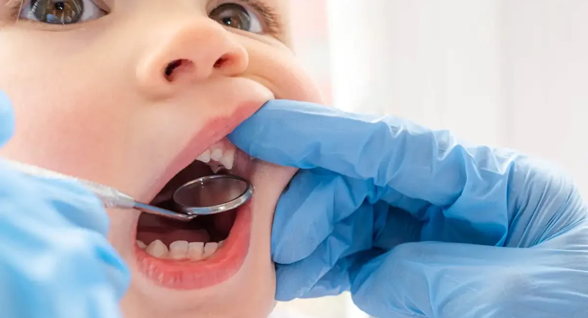 Children Dentistry