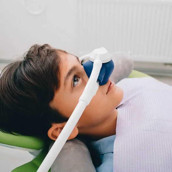 Laughing Gas Sedation