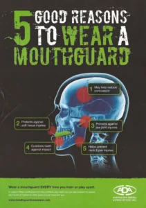 Play it safe, Wear a mouthguard