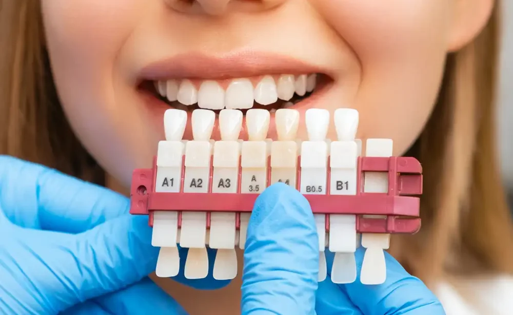 Veneers, Crowns & Bridges